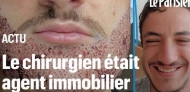 Jacques a perdu son fils après une greffe de barbe ratée en Turquie