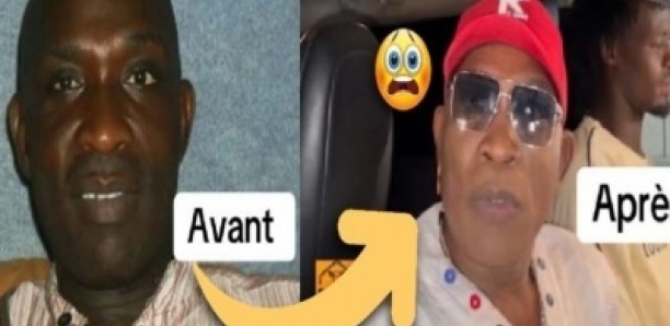 People: teint clair, boucle d'oreille, le Come- back polémique de l'artiste Gorgui Ndiaye