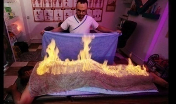 Un Masseur Utilise Le Feu Pour Soulager Les Douleurs Musculaires